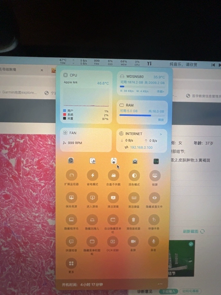 Best Phone Cooler for Gaming Kit Black photo review